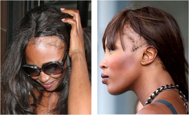 naomi-campbell-bald1