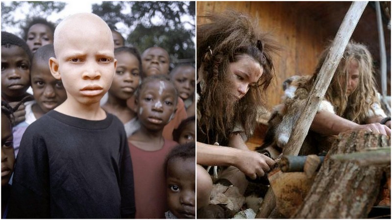 C'est l'albinisme, qui est né en Afrique, qui est à l'origine de la peau blanche des Européens 