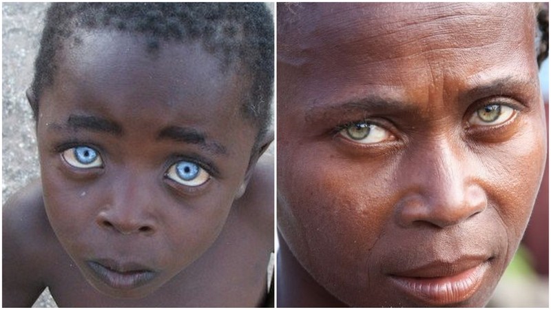 Des Africains avec des yeux bleus et verts 