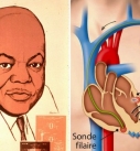 Otis Boykin, l’électronicien africain-américain qui contribua à développer le pacemaker
